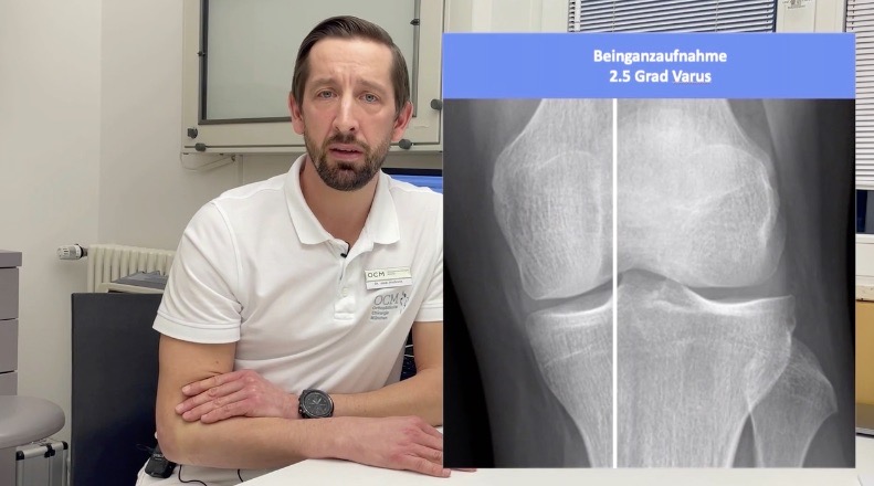 FKT@Home 2022 (Day 2) - Treatment of Cartilage Defects in the Knee – thumbnail 9 of 11