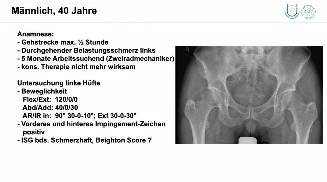 AGAnywhere Monthly - #023: Hüftdysplasie und/oder FAI? – thumbnail 9 of 12