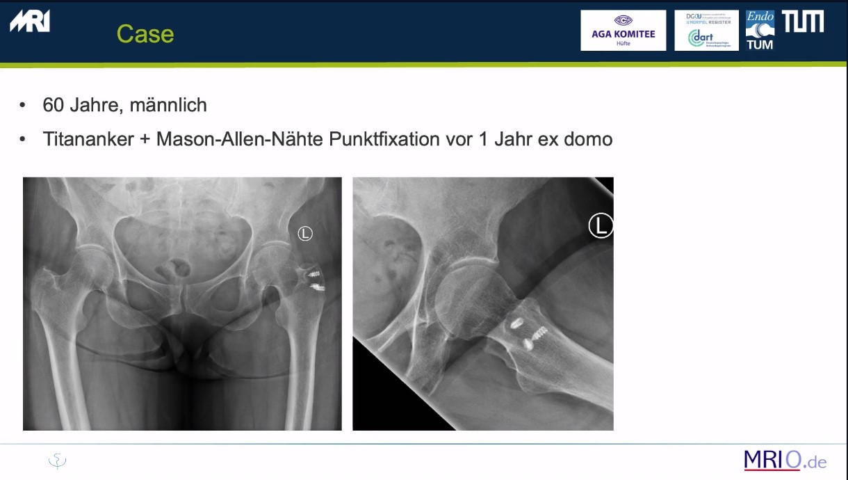 AGAnywhere Monthly - #028: Biomaterialien - Trends in der Knorpel- und Knochenregeneration – thumbnail 9 of 11