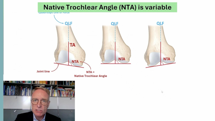 Winglet Originals #027: Technically Assisted Knee Arthroplasty – thumbnail 9 of 13