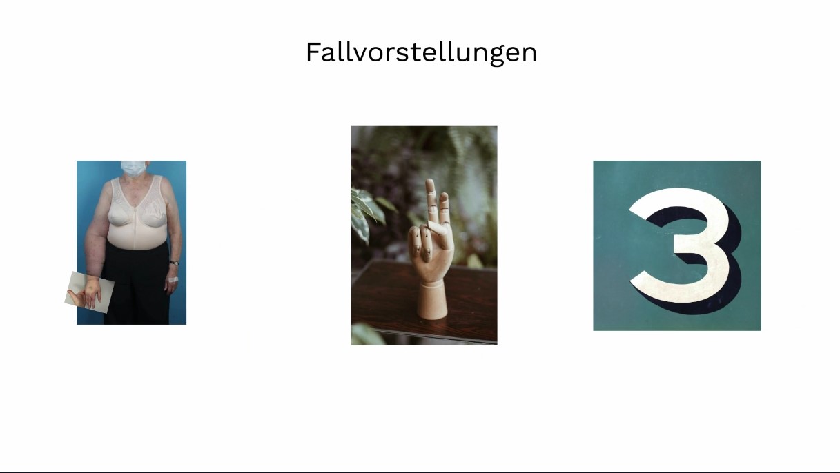 #307: Faszination Lymphologie: Lymphödem & Lipödem – thumbnail 9 of 12