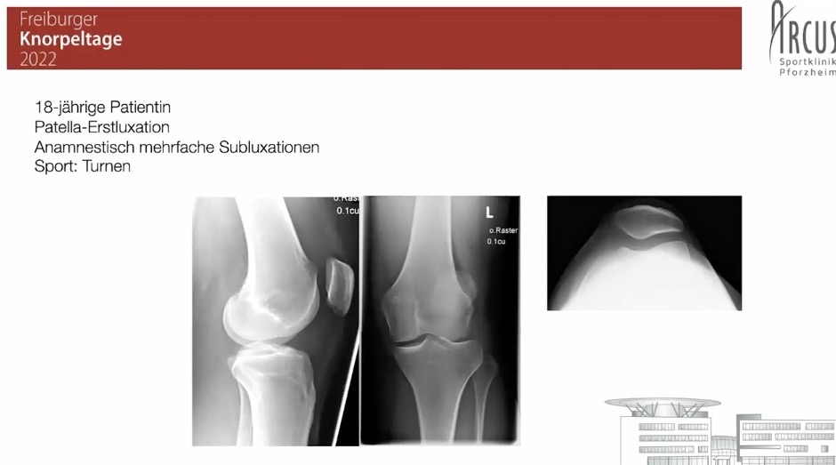 FKT@Home 2022 (Tag 1) - Knorpelregeneration am Kniegelenk – thumbnail 9 of 10