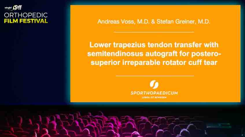 Orthopedic Film Festival 2022 - Upper Extremity – thumbnail 9 of 19