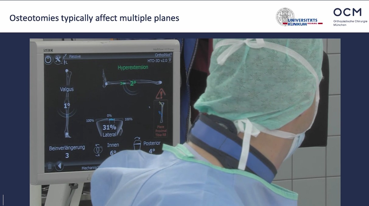 Winglet Originals #022: Osteotomies Around the Knee - Deformity Analysis and its Relevance for Surgical Correction – thumbnail 9 of 12