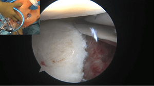 #711: Shoulder International – thumbnail 9 of 12