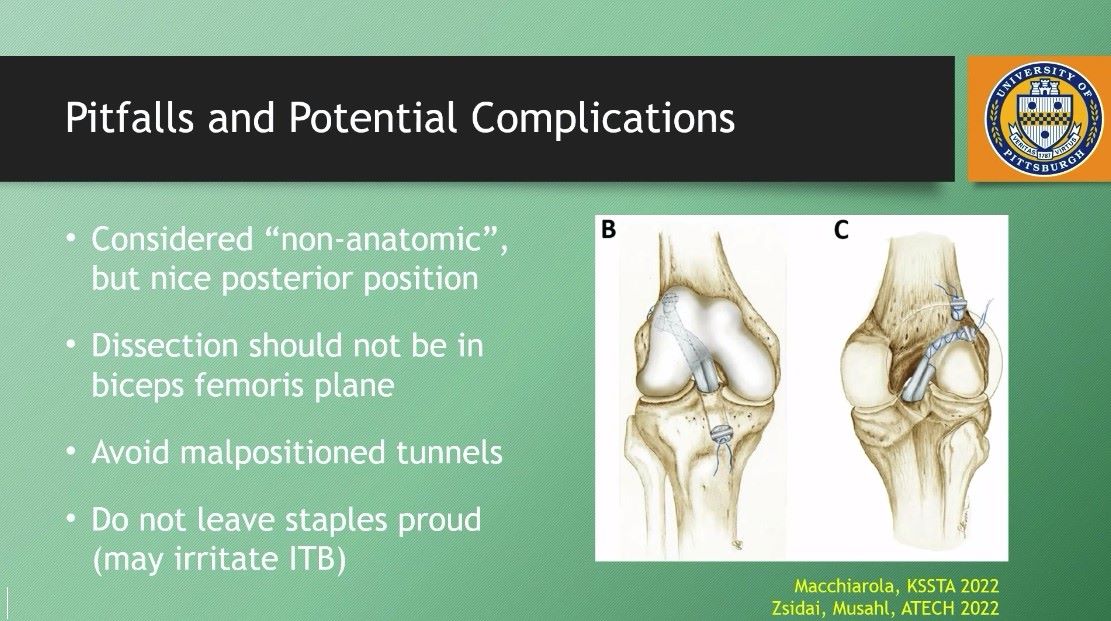Winglet Originals #012: ACL Reconstruction – thumbnail 9 of 13