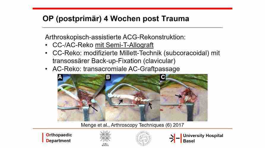 AGAnywhere Monthly - #018: Komplikationen und Management bei ACG-Instabilität – thumbnail 9 of 11