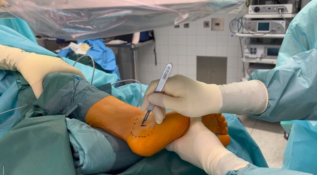 Winglet Originals #013: Minimally Invasive Foot Surgery – thumbnail 9 of 13