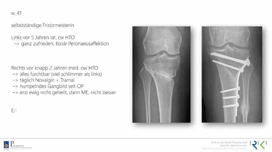 AGAnywhere Monthly - #017: Osteotomie advanced - Was geht alles? – thumbnail 9 of 11