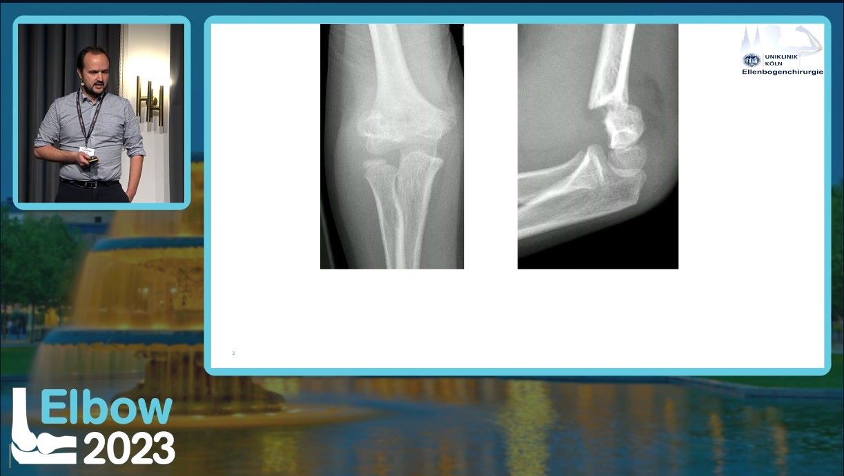 Elbow 2023 – thumbnail 9 of 38