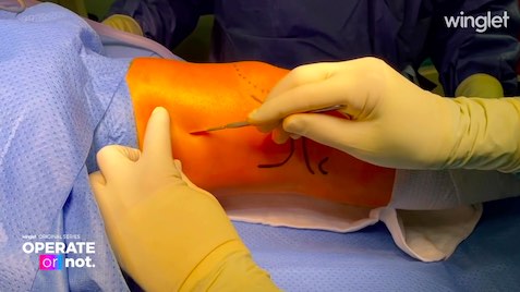 Winglet Originals #002: Indications for Osteotomies Around the Knee – thumbnail 9 of 12