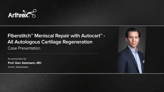 #033: ACL and Meniscal Repair – Case Presentations – thumbnail 2 of 2