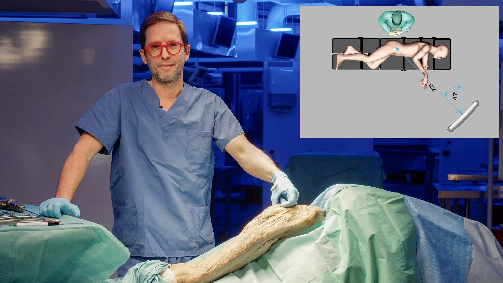 #105: Femoral Revision Surgery Using a Straight Modular Revision Stem ...