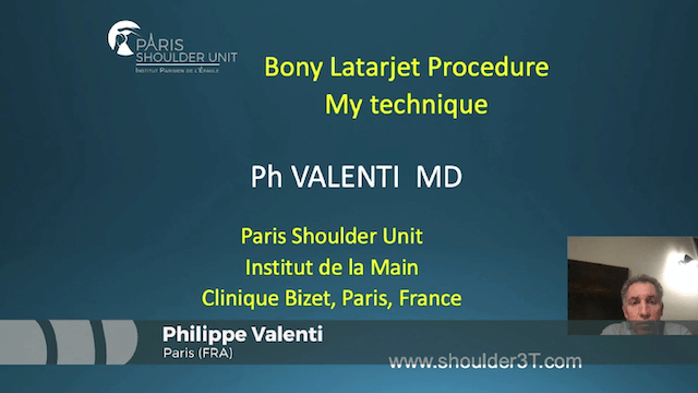 #126: New Trends in Anterior Shoulder Instability – thumbnail 7 of 8