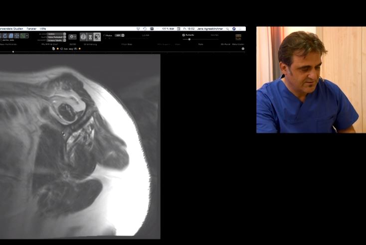 Hanover Live Surgeries - Cuff & Biceps Management – thumbnail 3 of 4